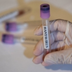 dunya-saglik-orgutunden-hantavirus-aciklamasi-kuresel-risk-dusuk-SrWIXGI8.jpg