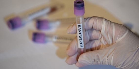 dunya-saglik-orgutunden-hantavirus-aciklamasi-kuresel-risk-dusuk-SrWIXGI8.jpg