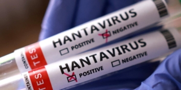 hantavirus-abd-korede-buldu-dunyaya-yaydi-j5njKDdK.jpg