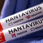 hantavirus-alarmi-sonrasi-abd-harekete-gecti-rpFPAkaC.jpg