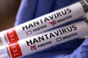 hantavirus-alarmi-sonrasi-abd-harekete-gecti-rpFPAkaC.jpg