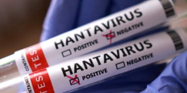 hantavirus-alarmi-sonrasi-abd-harekete-gecti-rpFPAkaC.jpg