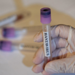 hantavirus-bir-ulkede-daha-goruldu-VRDXIO8Q.jpg