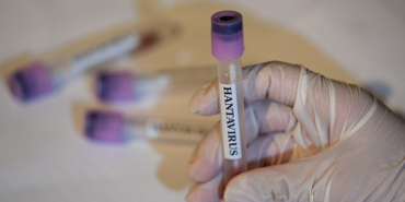 hantavirus-bir-ulkede-daha-goruldu-VRDXIO8Q.jpg
