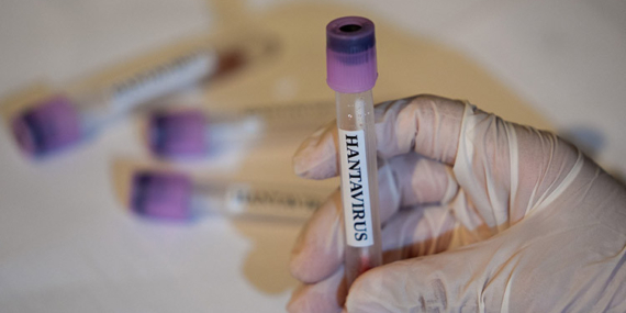 hantavirus-bir-ulkede-daha-goruldu-VRDXIO8Q.jpg