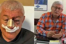sol-parti-usak-il-sozcusu-uludag-5-kisinin-saldirisina-ugradi-cete-mafya-gazeteciligi-yapiyorlar-QD7D2URO.webp